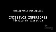 PROTOCOLO DE BIOSSEGURANCA DA TECNICA RADIOGRAFICA INTRAORAL TECNICA RADIOGRAFICA PERIAPICAL DENTES INFERIORES TECNICA RADIOGRAFICA PERIAPICAL DENTES SUPERIORES - Parte 2